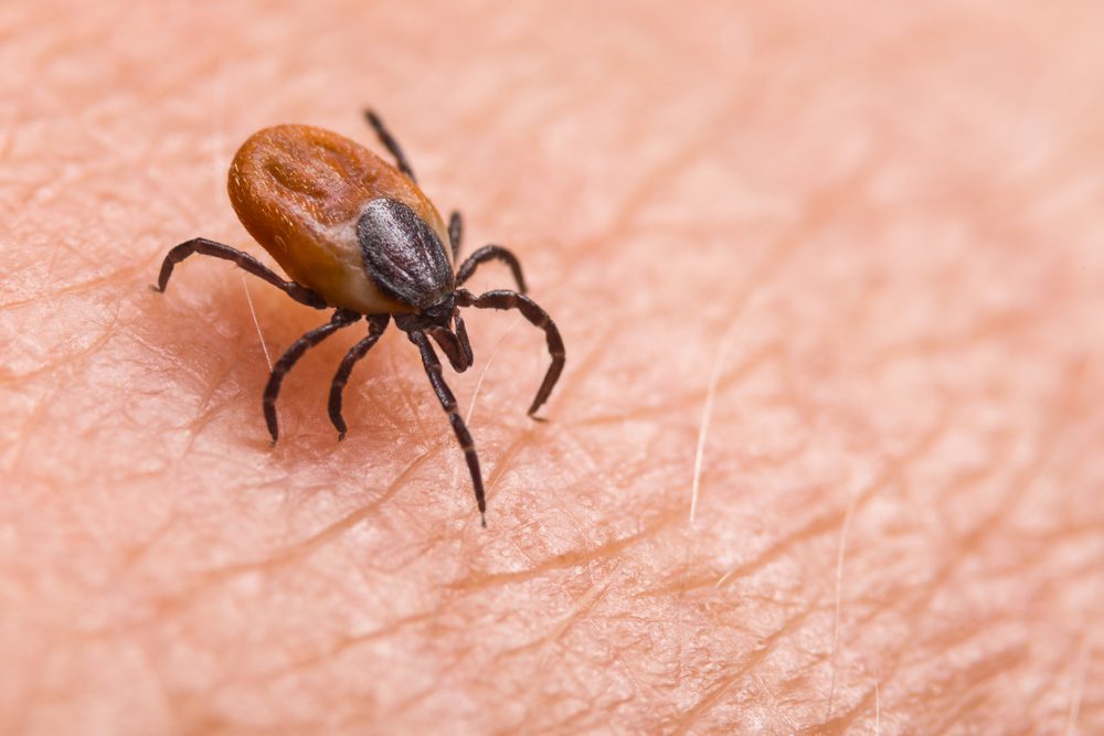 tick bite
