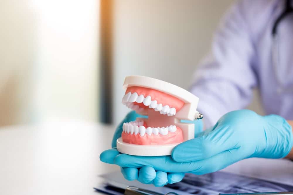 Dentures Vs Implants