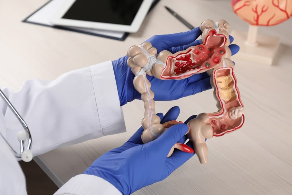 signs your colon needs help