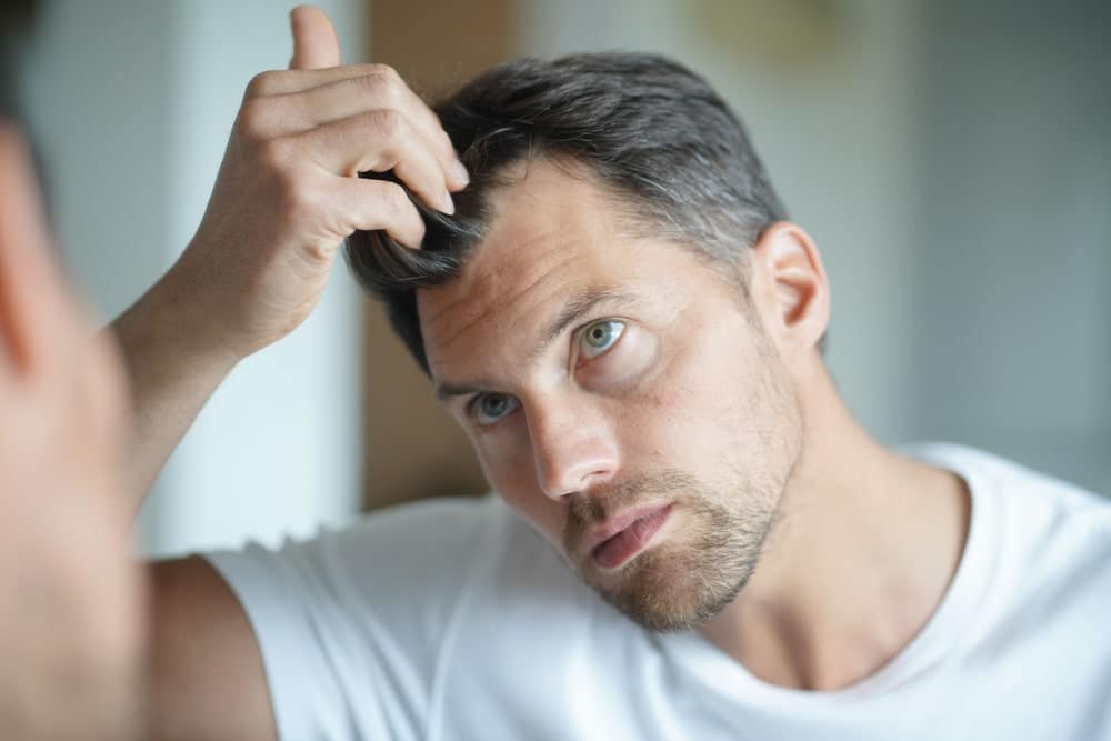 hair loss