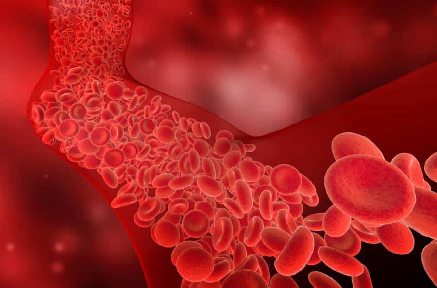 Blood clot, signs