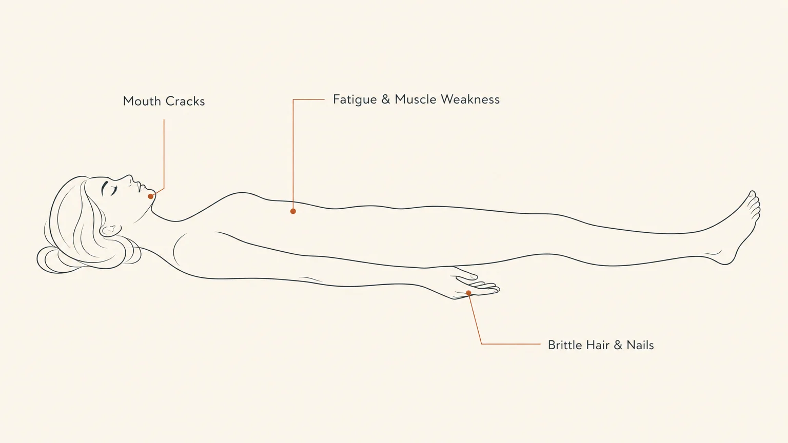 A clean, horizontal diagram showing a minimalist human outline with labels pointing to common vitamin deficiency symptoms.