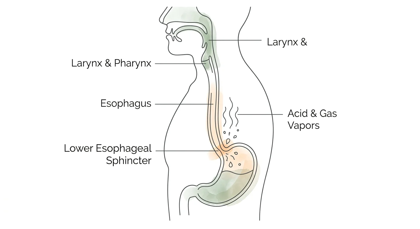 Anatomical line-art diagram showing how stomach acid travels up the esophagus to irritate the larynx and upper airways.