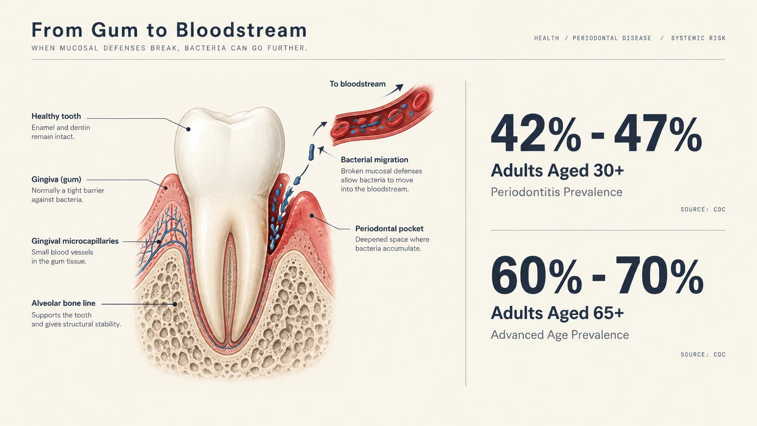 Medical diagram showing bacteria entering blood vessels via a periodontal pocket alongside CDC adult prevalence statistics.