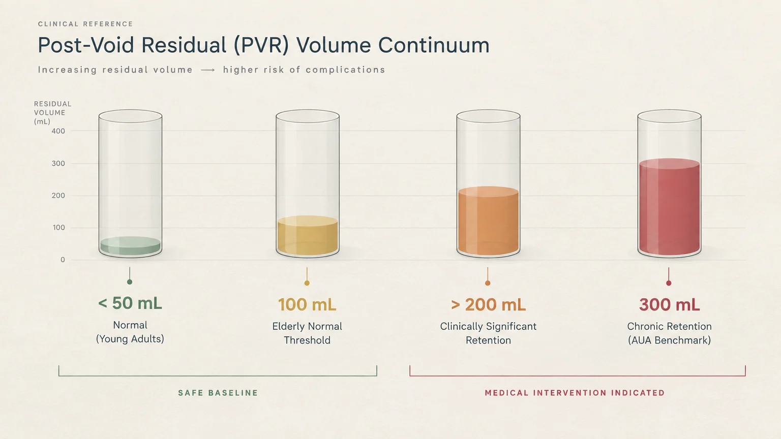 Diagram of four glass cylinders comparing post-void residual urine levels at 50 mL, 100 mL, 200 mL, and 300 mL.