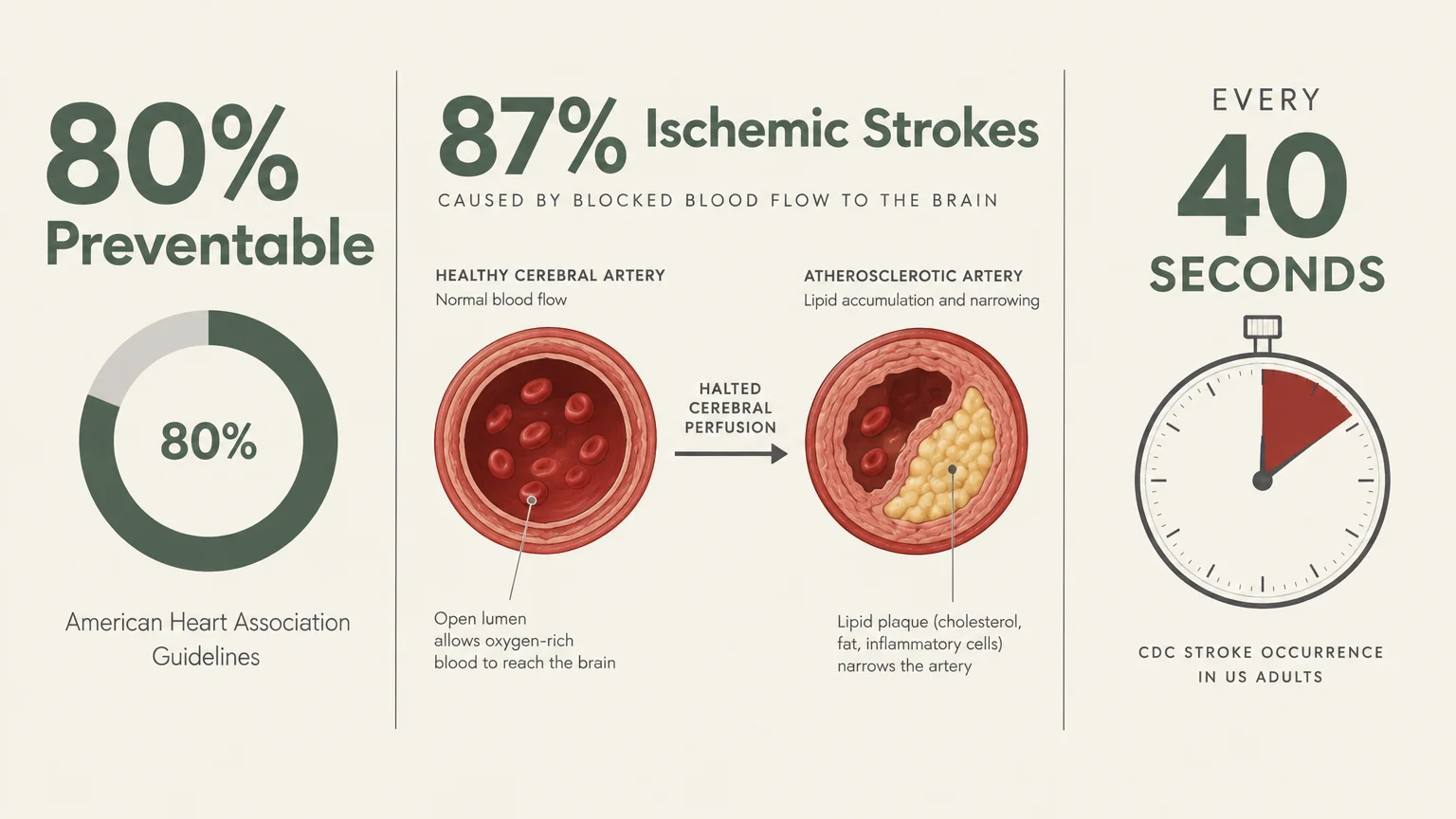Diagram illustrating 80% preventable strokes, cross-sections of healthy and blocked arteries, and a 40-second timer.