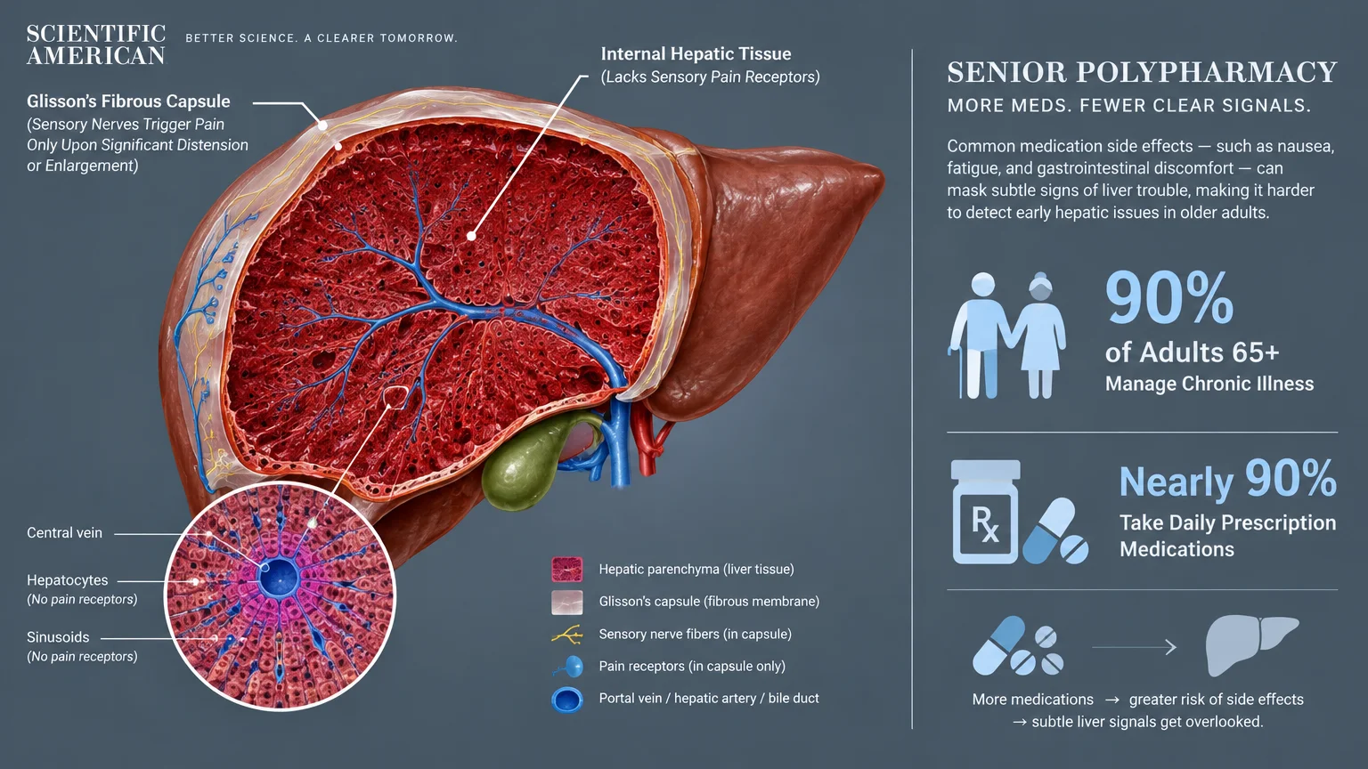 Medical diagram of liver cross-section showing internal tissue without pain receptors alongside senior polypharmacy stats.
